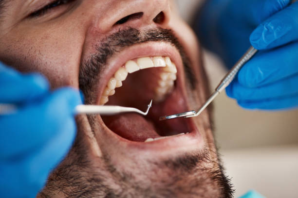 Best Urgent Tooth Repair  in Manassas Park, VA